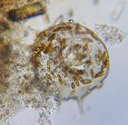 формування раковинки амеби Centropyxis aculeata