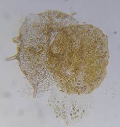 раковинка Centropyxis aculeata