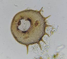 раковинка Centropyxis aculeata молода
