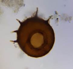 раковинка Centropyxis aculeata стара
