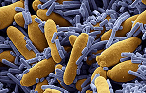 Кисломолочні бактерії під мікроскопом